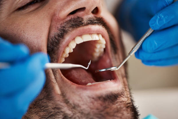 Best Emergency Dentist for Lost Fillings or Crowns in Dorothy, NJ