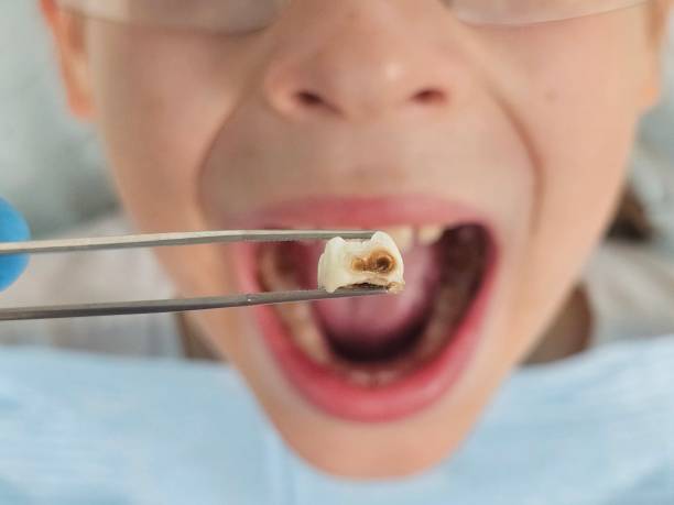 Best Pediatric Emergency Dentist in Dorothy, NJ